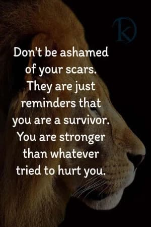 Don't be ashamed of your scars. They are just reminders that you are a survivor. You are stronger than whatever tried to hurt you.
